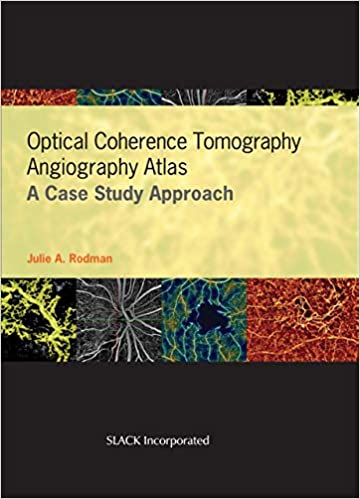 Optical Coherence Tomography Angiography Atlas - Orginal Pdf